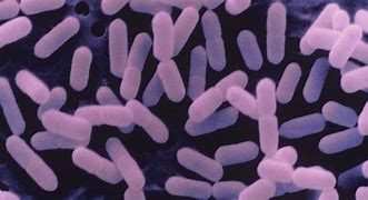 Image result for Listeria Symptoms
