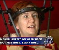 Image result for Decapitated Head