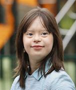 Image result for Down Syndrome Black People