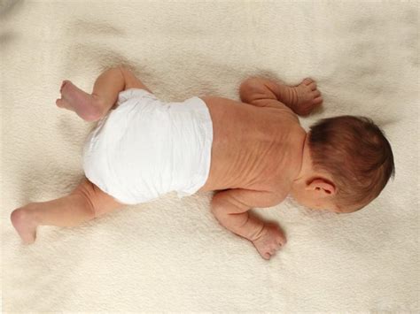 7 Surprising Home Remedies for Diaper Rashes   Organic Facts
