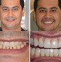 Image result for Digital Restorative Dentistry