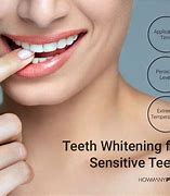 Image result for Blue Light Teeth Whitening