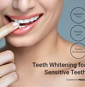 Image result for Teeth Whitening Procedure