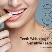 Image result for Teeth Whitening Strips Product