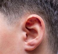 Image result for Bruising Behind Ear