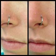 Image result for Nose Piercing Scar