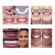 Image result for Magic Teeth Brace Perfect Smile Snap On Veneers