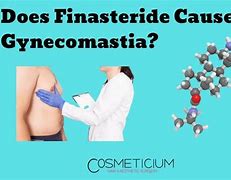 Image result for Finasteride Gynecomastia Severe