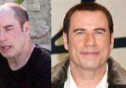 Image result for John Travolta No Hair