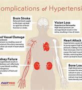Image result for Hypertension
