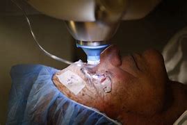 Image result for Laser Eye Surgery Procedure