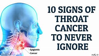Image result for Stage 1 Throat Cancer