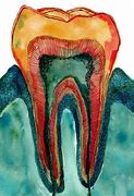 Image result for Teenager Teeth