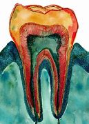 Image result for Flossing Teeth Bleeding