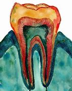 Image result for Teeth Cleaning Under Gums