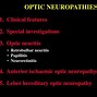Image result for Retrobulbar Optic Neuritis