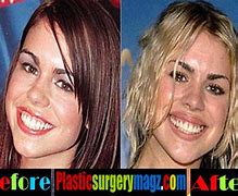 Image result for Billie Piper Surgery