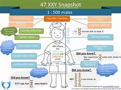 Image result for 47 XXY Female