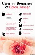 Image result for Stage 4 Small Intestine Cancer