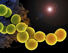 Image result for Superbug Infection