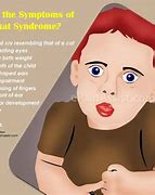 Image result for CRI Du Chat Symptoms Diagram