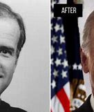 Image result for Joe Biden Hair Transplant