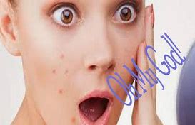 Image result for How to Remove Blemishes On Face
