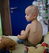 Image result for Child with Cancer