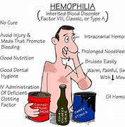 Image result for Hemophilia