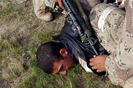 Image result for Graphic Iraq War Injuries