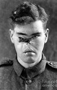Image result for War Trauma Facial Injury