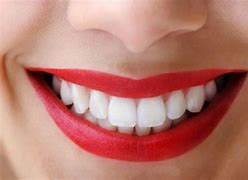 Image result for Dents in Teeth