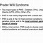 Image result for PWS Syndrome