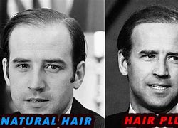 Image result for Joe Biden Hair Back