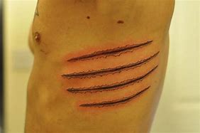 Image result for claws on flesh on the side of body