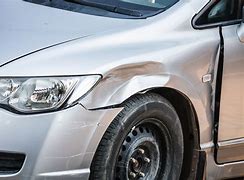 Image result for Dented Front of Car