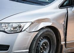 Image result for Dented Car Drivers Door