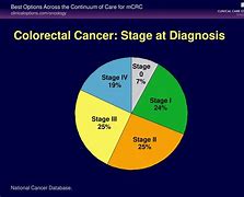 Image result for Stage 4 Colorectal Cancer