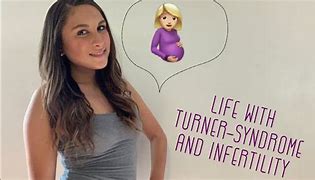 Image result for Turner Syndrome Pregnancy