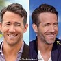Image result for Ryan Reynolds Surgery