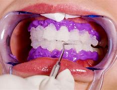 Image result for La Brosse a Dents