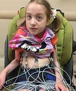 Image result for People with Rett Syndrome
