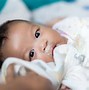 Image result for Vomiting in Babies with Trisomy 18