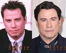 Image result for Travolta Face Lift