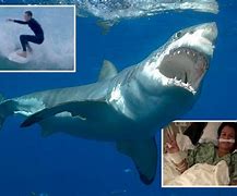 Image result for Shark Attacks On People