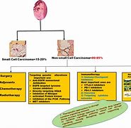 Image result for Stage 4 Non-Small Cell Lung Cancer