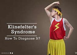 Image result for Famous Model with Klinefelter Syndrome