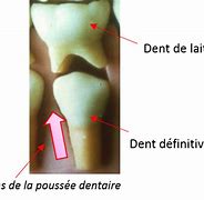 Image result for La Dent