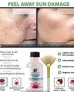 Image result for Peeling Skin Cream