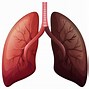 Image result for Central vs Peripheral Lung Cancer